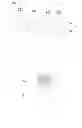 Fig. 05 - Battery explosion-proof device and battery pack comprising the same