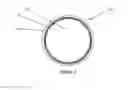 Fig. 02 - Coated Orthodontic Appliance