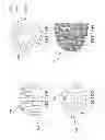 Fig. 14 - Medical apparatus and method for collecting biological samples