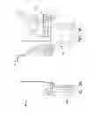 Fig. 26 - Medical apparatus and method for collecting biological samples