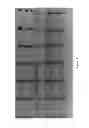Fig. 16 - Biological methods for preparing adipic acid