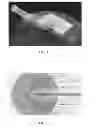 Fig. 04 - LASER ABLATION CELL AND TORCH SYSTEM FOR A COMPOSITIONAL ANALYSIS SYSTEM