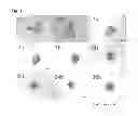 Fig. 02 - Cancer tissue-derived cell mass and a process for preparing same