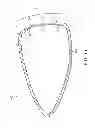 Fig. 03 - Golf club head with replaceable face