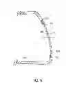 Fig. 07 - Golf club head with replaceable face