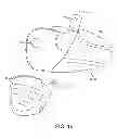 Fig. 17 - Golf club head with replaceable face