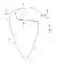 Fig. 19 - Golf club head with replaceable face