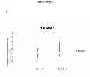 Fig. 07 - IN VITRO METHOD FOR PREDICTING SEMEN FERTILITY