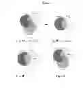 Fig. 08 - Methods and compositions for diagnosis of thyroid conditions