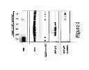 Fig. 03 - Methods for modulating factor 12 expression