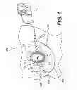 Fig. 02 - Accelerated partial breast irradiation with shielded brachytherapy applicator system and method of use