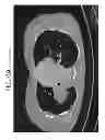 Fig. 09 - Sequentially programmed magnetic field therapeutic system (SPMF)