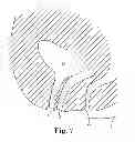 Fig. 08 - Pelvic health implants and methods