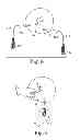 Fig. 09 - Pelvic health implants and methods