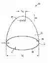Fig. 01 - System for treating pelvic organ prolapse including a shell and an anchor