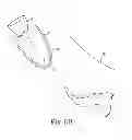 Fig. 08 - System for treating pelvic organ prolapse including a shell and an anchor