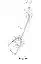 Fig. 09 - System for treating pelvic organ prolapse including a shell and an anchor