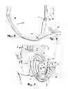 Fig. 04 - Sexual aid system