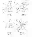 Fig. 02 - Feature differentiation image capture unit and method in a surgical instrument