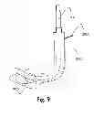 Fig. 08 - Laryngeal Mask Assembly