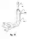 Fig. 09 - Laryngeal Mask Assembly