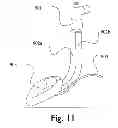 Fig. 10 - Laryngeal Mask Assembly