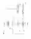 Fig. 14 - ELECTROENCEPHALOGRAM INTERFACE SYSTEM