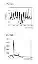Fig. 15 - ELECTROENCEPHALOGRAM INTERFACE SYSTEM