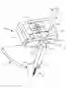 Fig. 01 - SURGICAL IMPLANT GUIDE SYSTEM AND METHOD