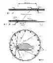 Fig. 03 - Supplemental transmission information for attenuation correction in positron emission tomography imaging
