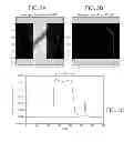 Fig. 05 - Supplemental transmission information for attenuation correction in positron emission tomography imaging