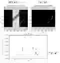 Fig. 06 - Supplemental transmission information for attenuation correction in positron emission tomography imaging
