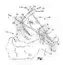 Fig. 02 - Methods for positioning a medical device in a respiratory system