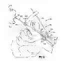 Fig. 09 - Methods for positioning a medical device in a respiratory system