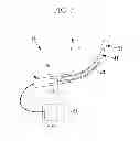 Fig. 03 - GUIDING-TYPE MEDICAL SYSTEM