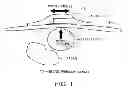 Fig. 02 - BLOOD-PRESSURE SENSOR