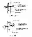 Fig. 07 - BLOOD-PRESSURE SENSOR