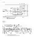Fig. 04 - SAMPLING AND STORAGE REGISTRY DEVICE FOR BREATH GAS ANALYSIS