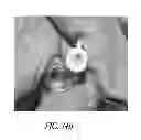 Fig. 52 - Adjustable connector and dead space reduction