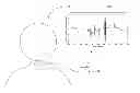 Fig. 01 - Method and device for swallowing impairment detection