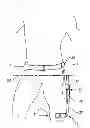 Fig. 01 - Hip Orthosis, Method for Preventing the Dislocation of a Hip and Use of a Hip Orthosis