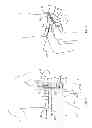 Fig. 02 - Hip Orthosis, Method for Preventing the Dislocation of a Hip and Use of a Hip Orthosis