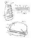 Fig. 02 - Lower spine brace