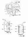 Fig. 06 - Lower spine brace