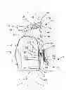 Fig. 01 - Apparatus and method for spinal distraction