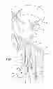 Fig. 02 - Apparatus and method for spinal distraction