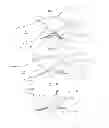 Fig. 04 - Phalangeal deformity ring splint