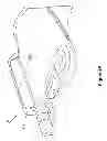 Fig. 06 - PNEUMATIC COMPRESSION BANDAGE