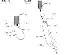 Fig. 11 - DELIVERY DEVICE WITH INVERTIBLE DIAPHRAGM