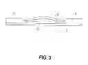 Fig. 04 - Transdermal integrated actuator device, methods of making and using same